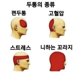 두통의 종류 편두통 고혈압 스트레스 니하는 꼬라지