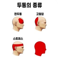 두통의 종류 만능짤 생성기